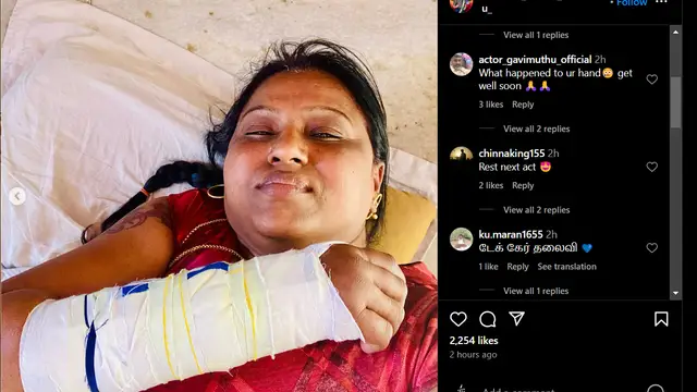 விபத்தில் சிக்கி படுகாயமடைந்த பாக்கியலட்சுமி சீரியல் நடிகை - புகைப்படத்தை கண்டு ரசிகர்கள் ஷாக்.